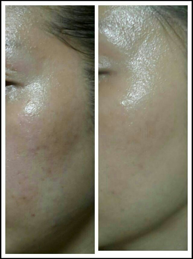 공주피부샾 이미지