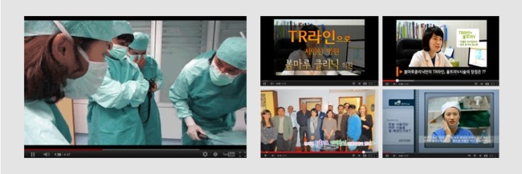 인크리브 이미지