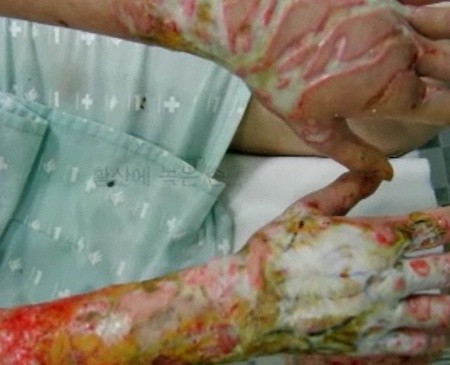 정아나고 이미지