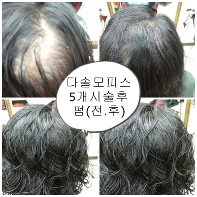 지헤어 이미지