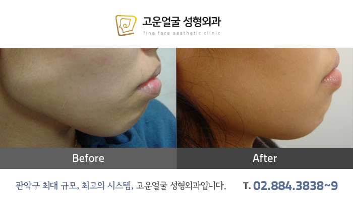 고운얼굴 이미지