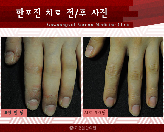 에세이피부과 이미지