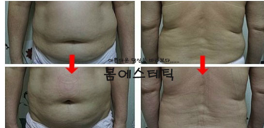 금불테라피 이미지