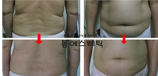 금불테라피 이미지