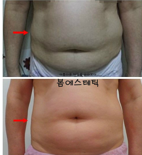 금불테라피 이미지