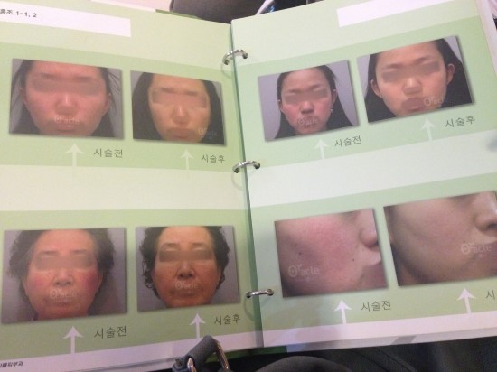 오라클피부과 이미지