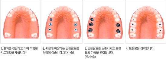보스턴웰치과 이미지