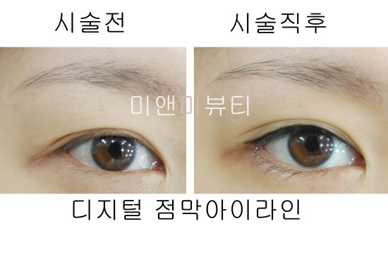 아이라인뷰티 이미지
