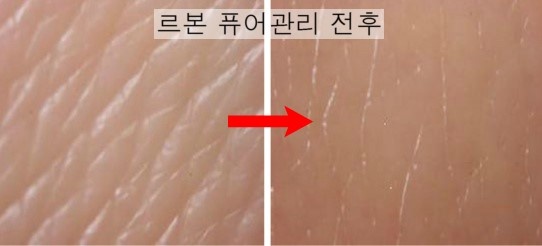 예인피부관리 이미지