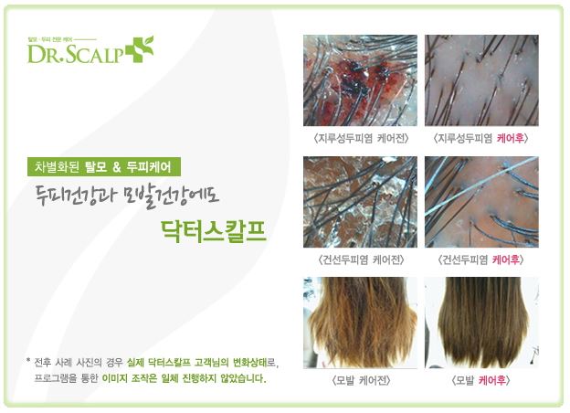 천궁호프 이미지
