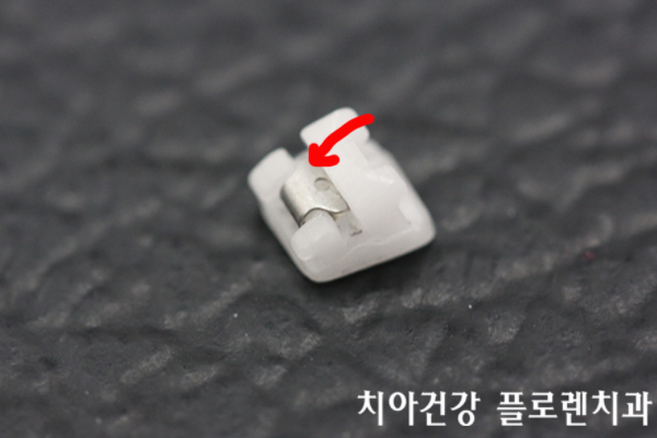 도이세라믹 이미지