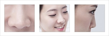 김종철성형외과 이미지