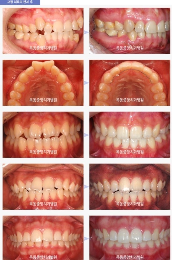 중앙치과 이미지