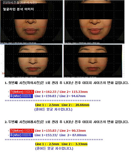 벨팜 이미지