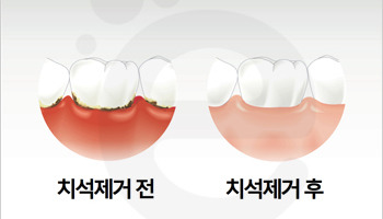 미시건치과 이미지