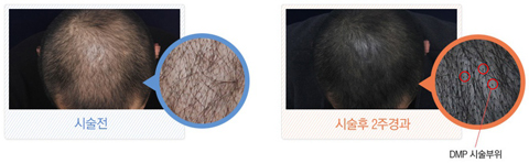 다나두피 이미지