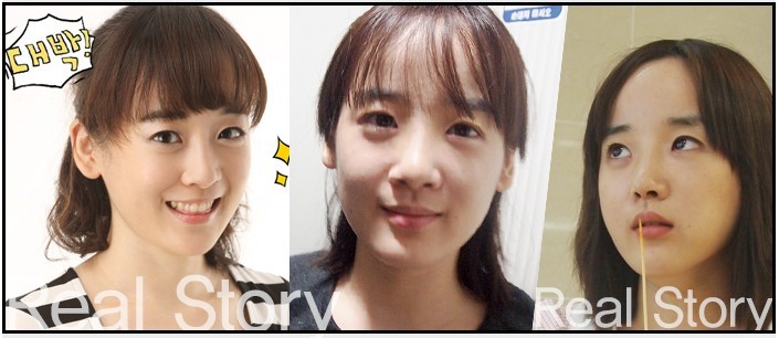 리얼성형외과 이미지