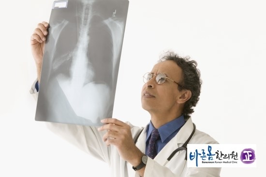 늑골집 이미지
