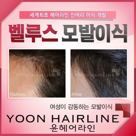 라인헤어 이미지