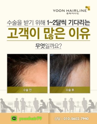 네오헤어 이미지