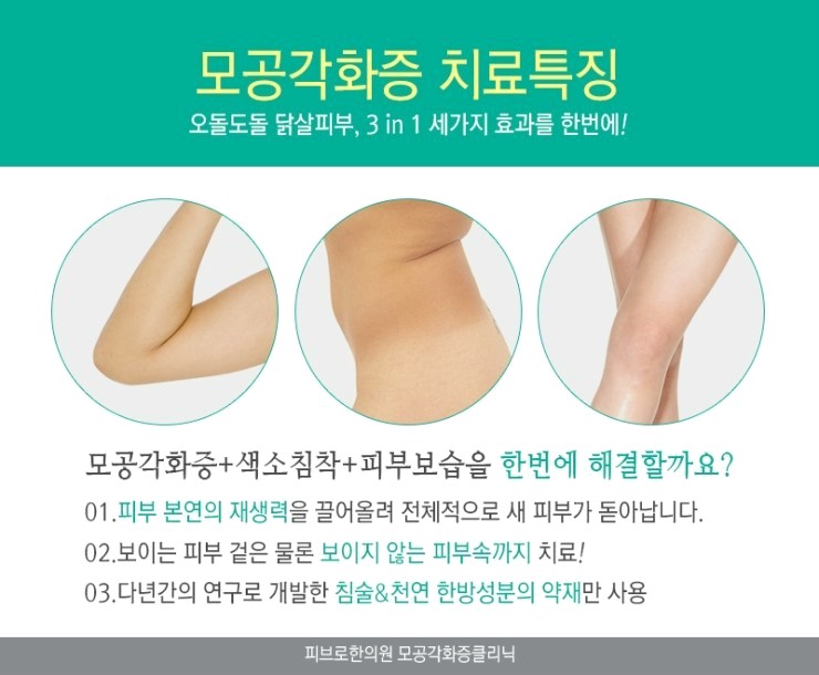 착한모공 이미지