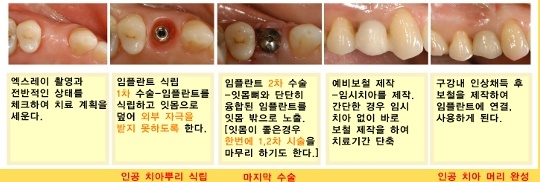 미시건치과 이미지
