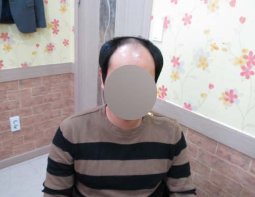 심는가발 이미지