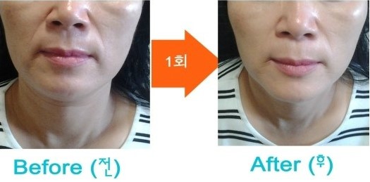예인피부관리 이미지