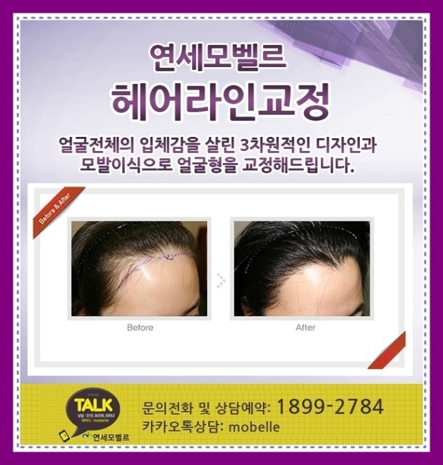라인헤어 이미지