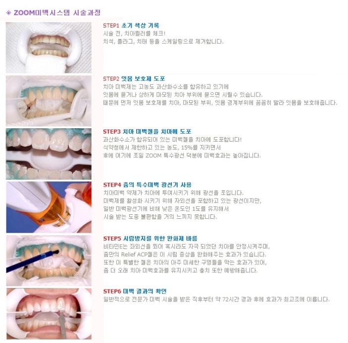 하얀미소치과 이미지