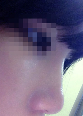 장익수성형외과 이미지