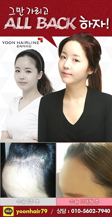라인헤어 이미지