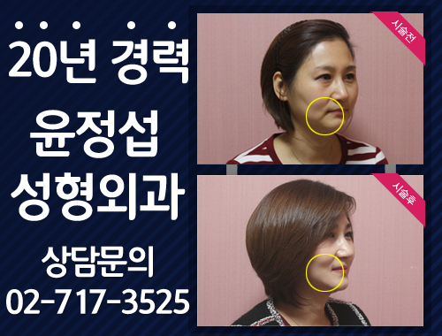 이지성형외과 이미지