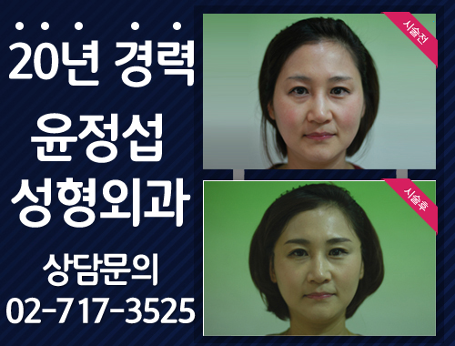 이지성형외과 이미지