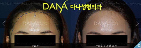 여백미헤어 이미지