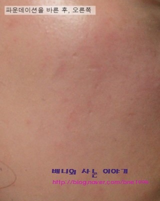 내츄럴선 이미지