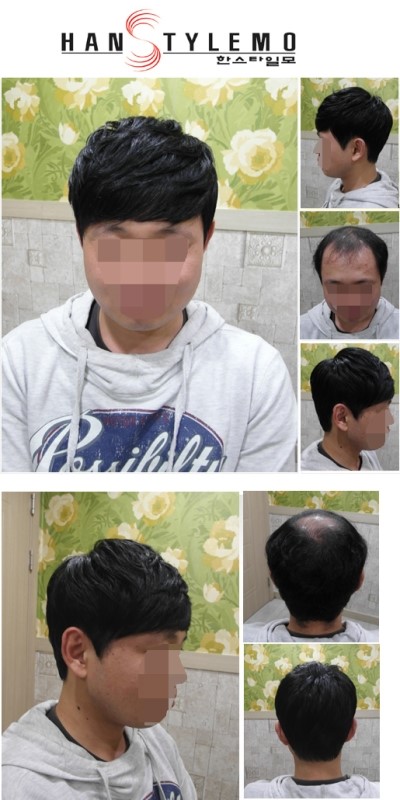 심는가발 이미지
