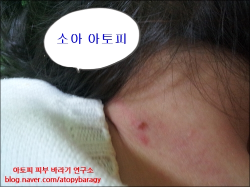 임브레이스 이미지