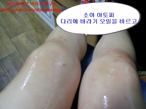 임브레이스 이미지