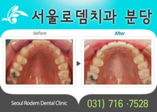 서울로뎀치과 이미지