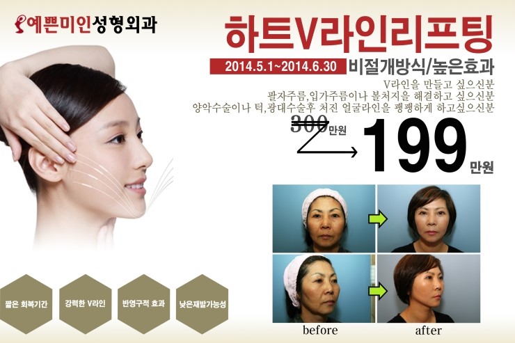 예쁜미인성형외과 이미지