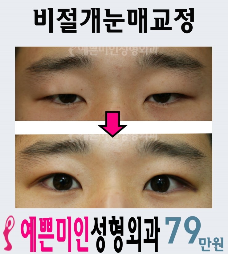 예쁜미인성형외과 이미지