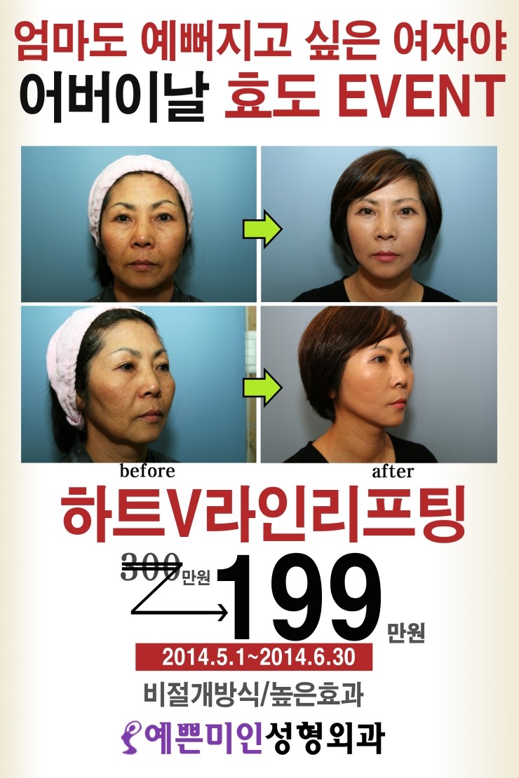 예쁜미인성형외과 이미지