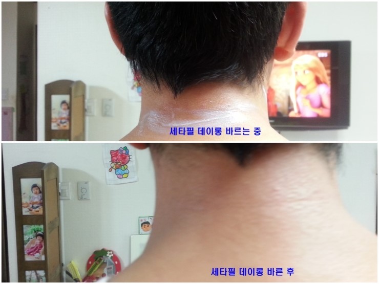 선 피부앤바디 이미지