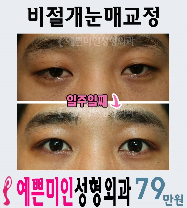 예쁜미인성형외과 이미지