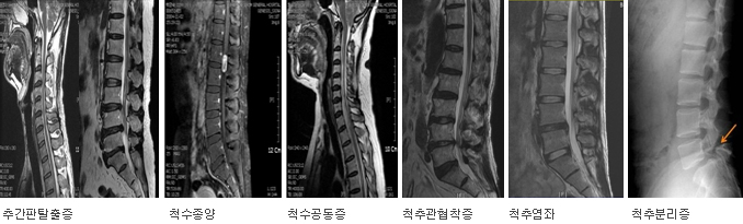 척추관절센터 이미지