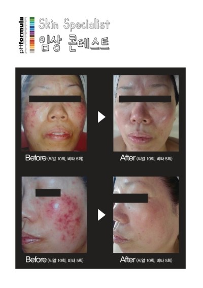 황실피부 이미지