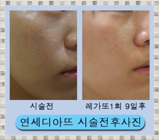 레가토 이미지