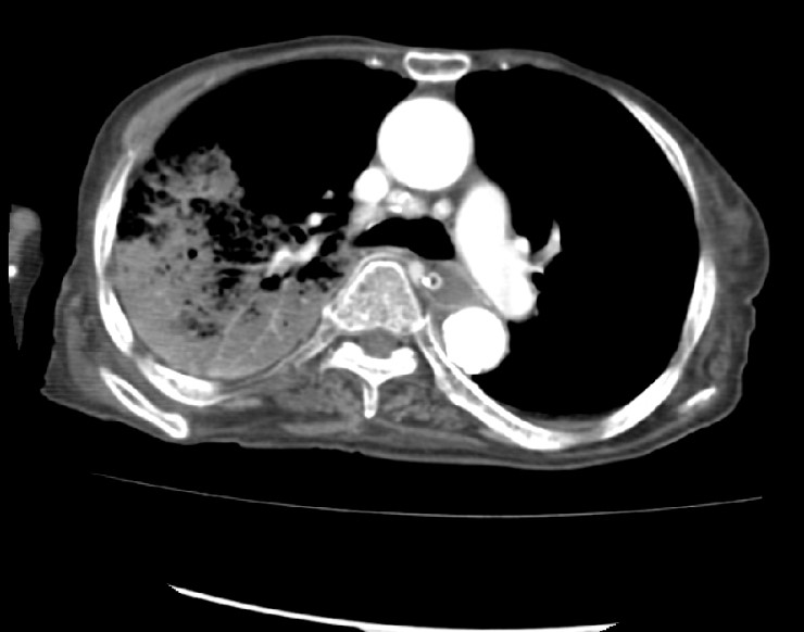Image result for as a widely used thermoplastic
