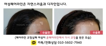 라인헤어 이미지